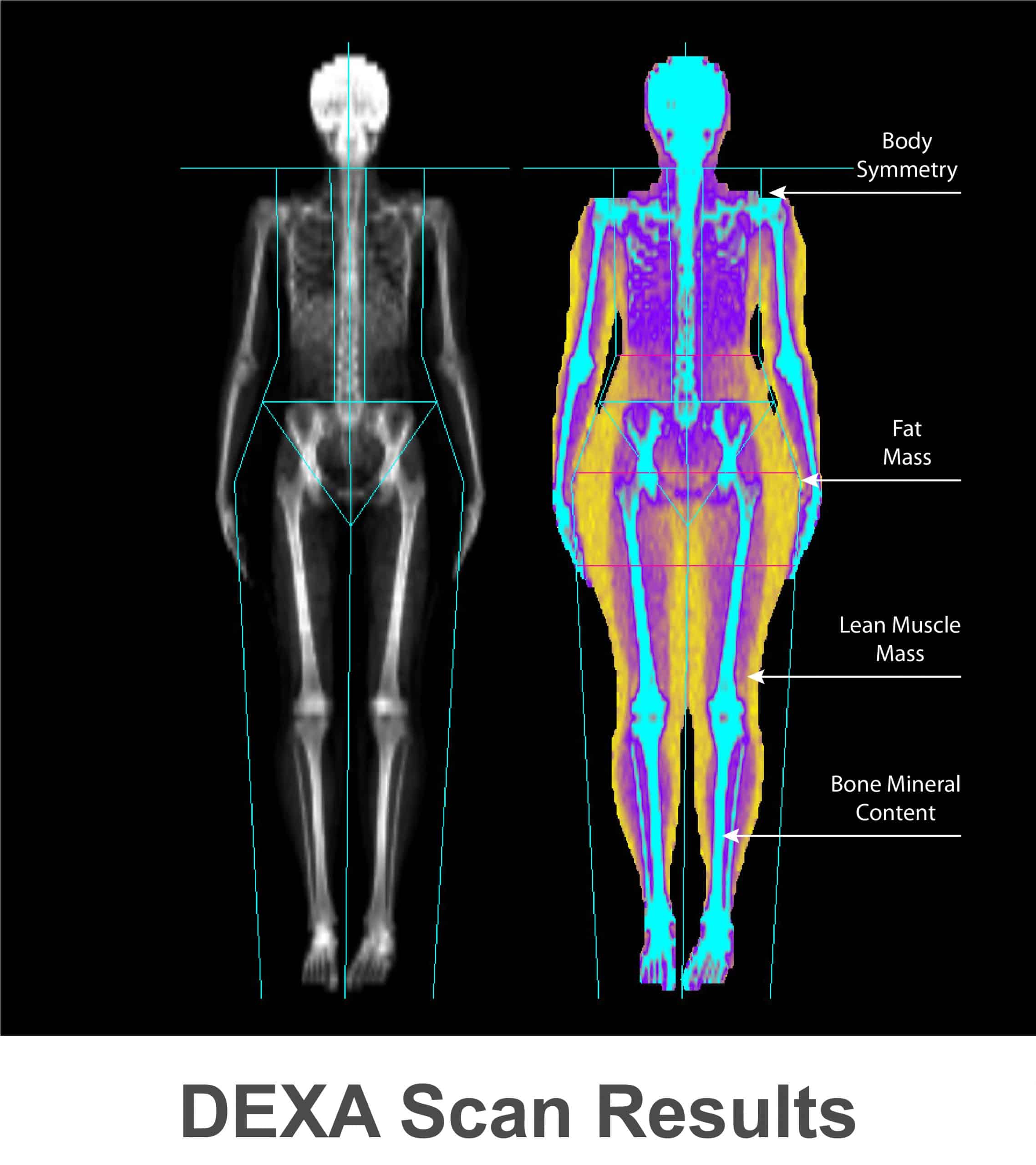 DEXA Source Endurance